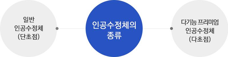 인공수정체란