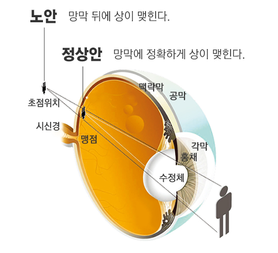 초점위치비교이미지