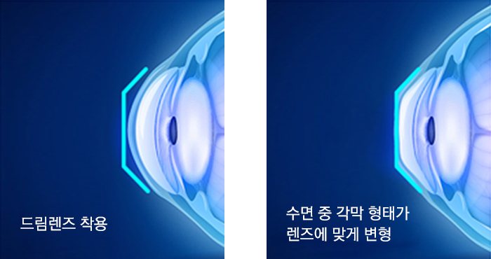 드림렌즈이미지